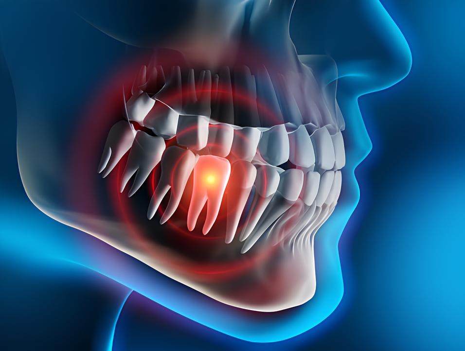 Teeth image - Emergency dentist Godalming